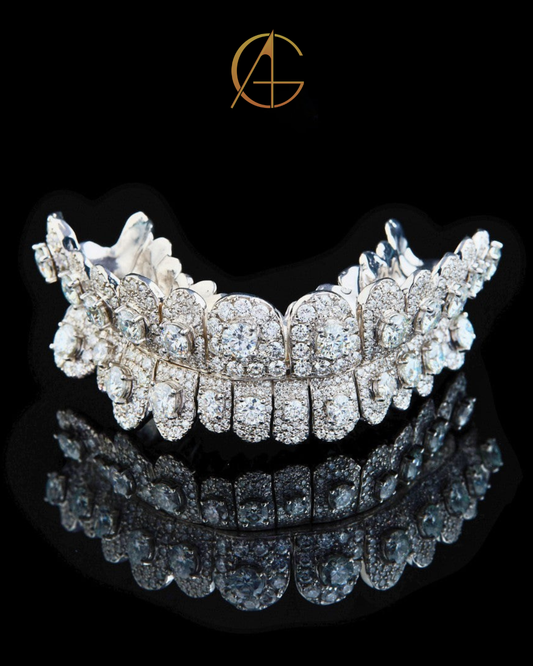 Iced-Out Diamond Grillz – Full Custom Luxury Mouthpiece by Auren Gems