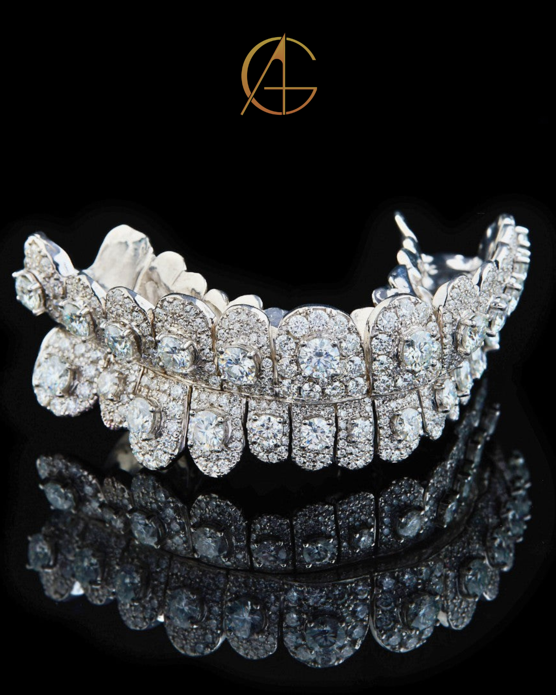 Iced-Out Diamond Grillz – Full Custom Luxury Mouthpiece by Auren Gems
