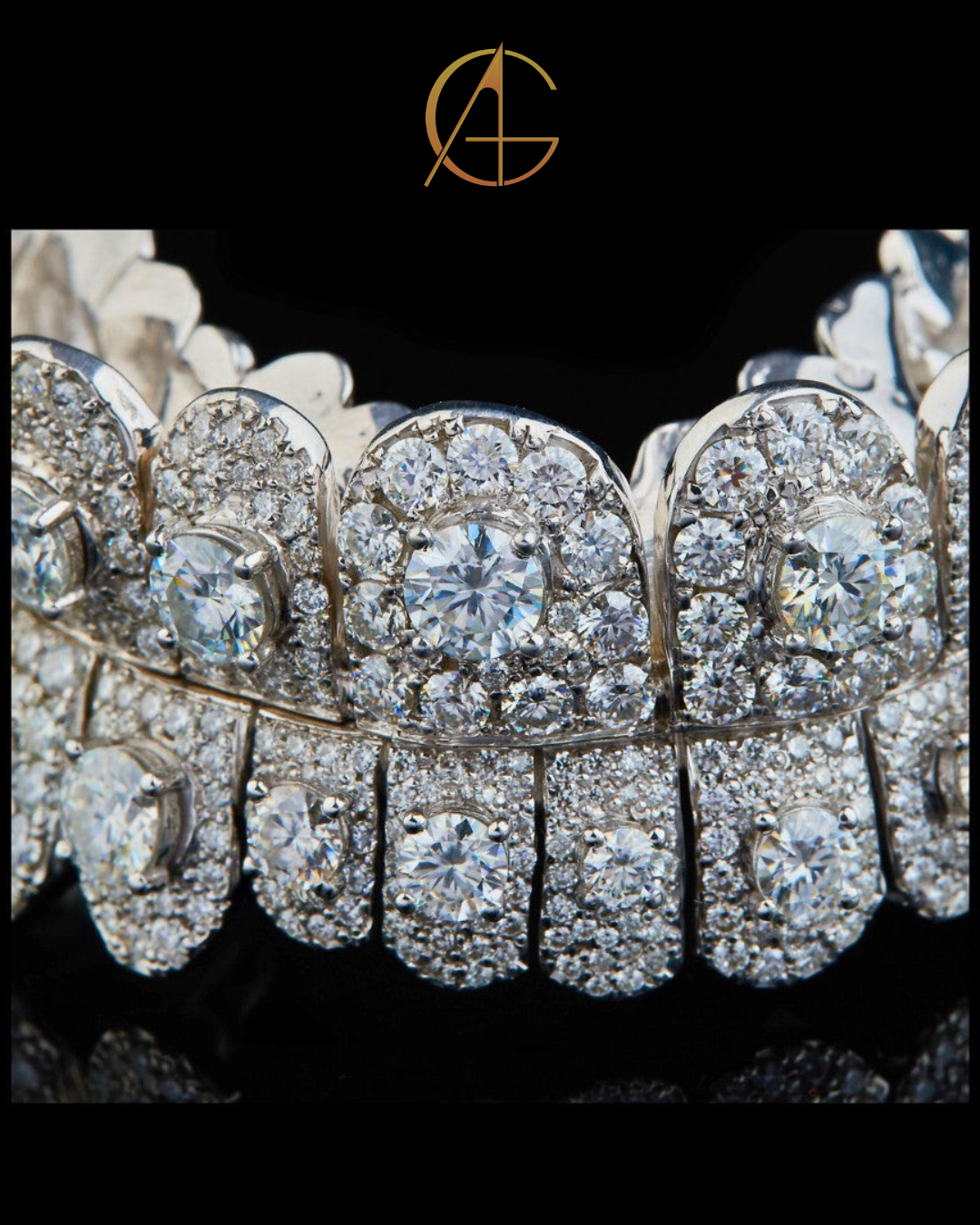 Iced-Out Diamond Grillz – Full Custom Luxury Mouthpiece by Auren Gems